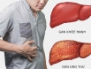 Ung thư gan có nguy hiểm không? Tìm hiểu ngay trước khi quá muộn.